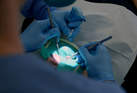 השתלות שיניים ביום אחד