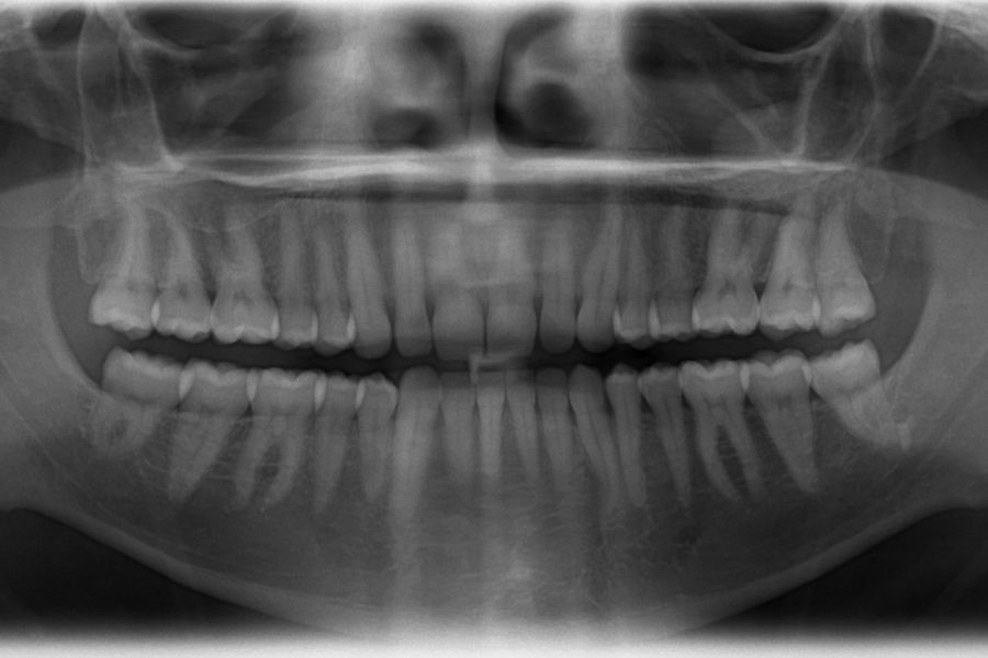 צילום פנורמי